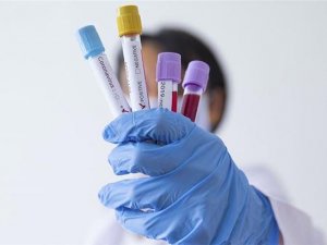 ABD'de yaşan Türk çift corona virüs test kiti üretti