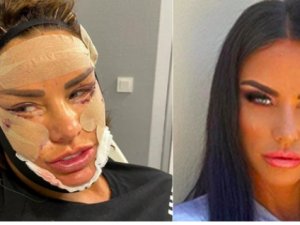 Türkiye'de estetik olan Katie Price evinde saldırıya uğradı