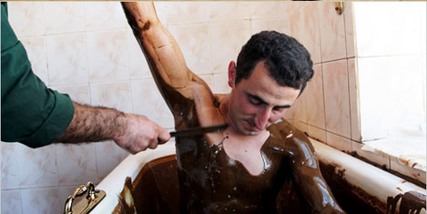 mehmet-satar-naftalan-6.jpg mehmet-satar-naftalan-6.jpg